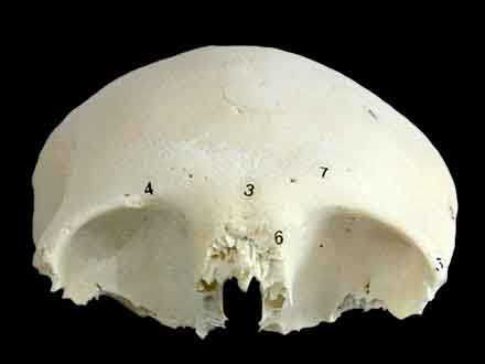 human frontal bone