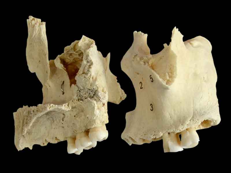 human maxilla anatomy specimen