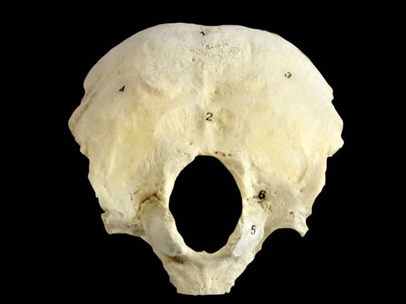human occipital bone specimen