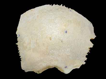 human parietal bone
