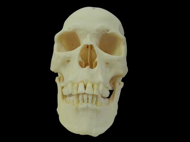 Human skull specimen