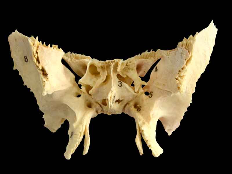 human sphenoid bone specimen
