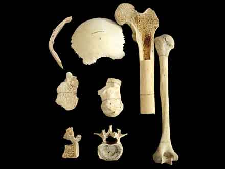 Internal structure and classification of bones