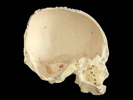 lateral wall of nasal cavity