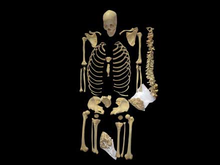 separation of human bones plastinated specimen