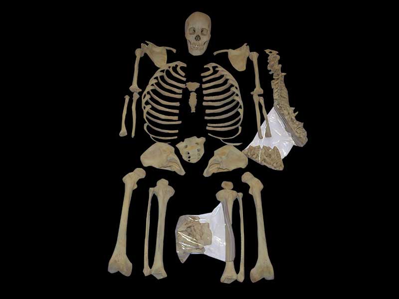 separation of human bones plastination