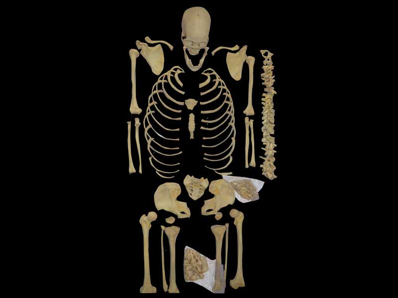 separation of human bones teaching specimen