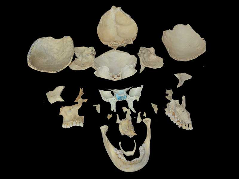 separation of human skull plastinated specimen