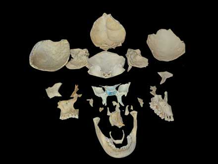 separation of human skull plastinated specimen