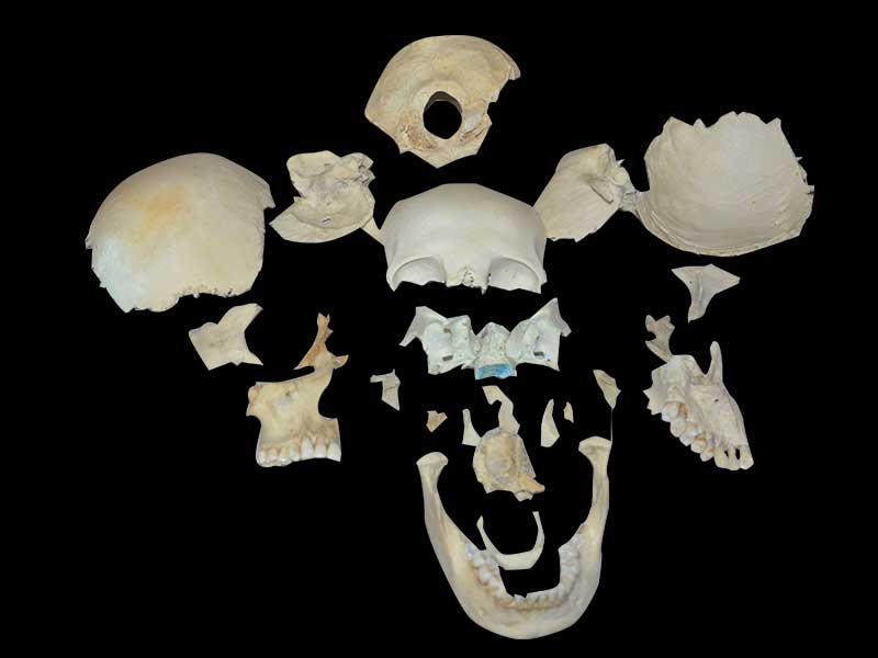 separation of human skull plastination