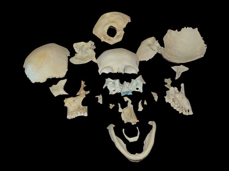 separation of human skull teaching specimen