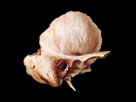 Temporal bone skeleton model (human skull bones  )