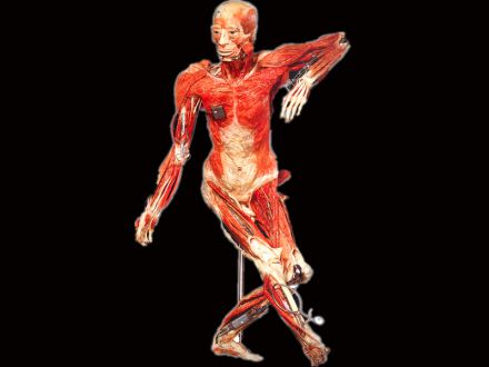 Dancing plastinated specimens