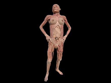 Pregnant woman plastinated specimen