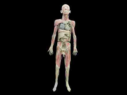 Whole body plastinaiton