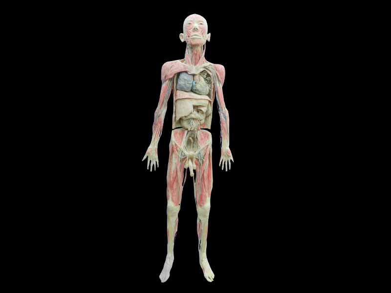 Whole body plastinaton