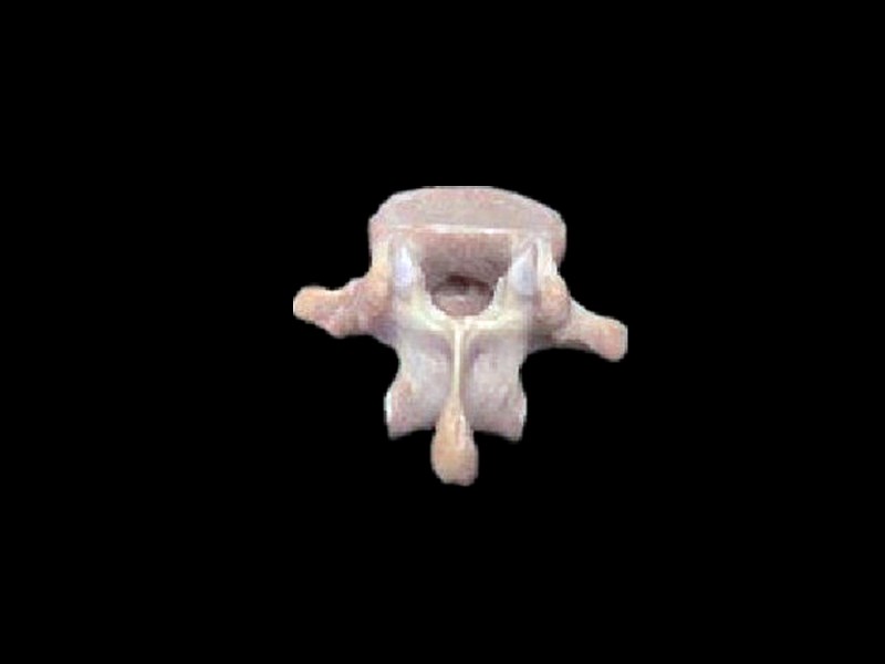 Lumbar vertebral skeleton model(  bones of human skull )