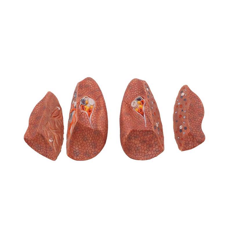 simulation lung anatomy model