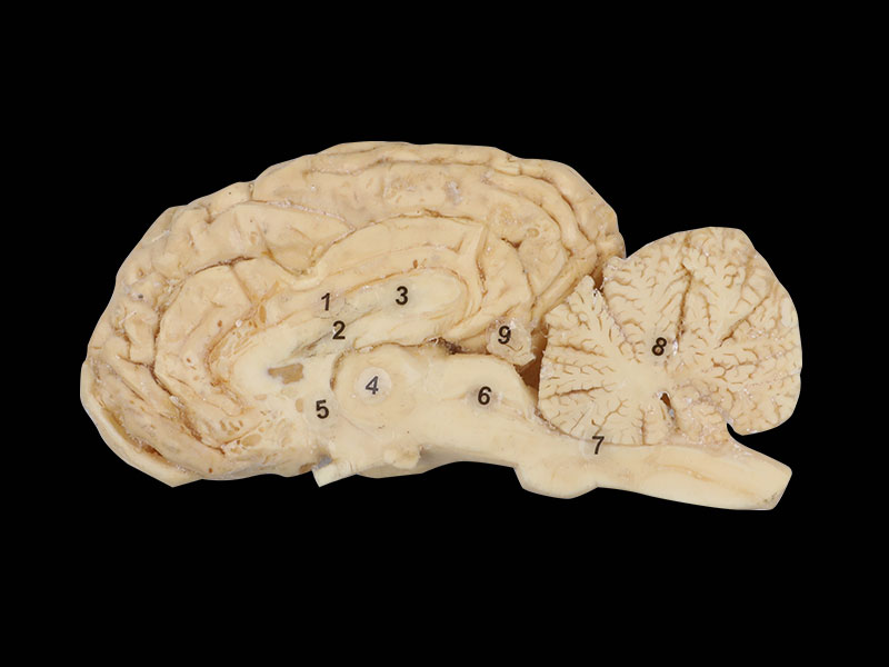 Midsagittal Section of Horse Brain Plastination specimen