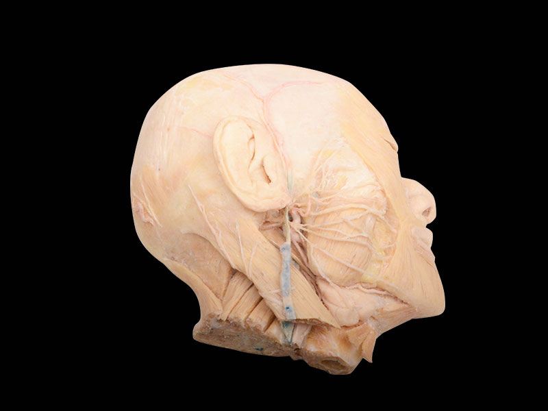 Plastinated human facial nerves and its branches