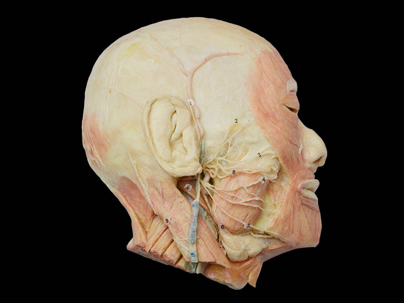 Plastinated human facial nerves