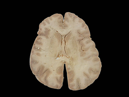 plastinated horizontal section of brain