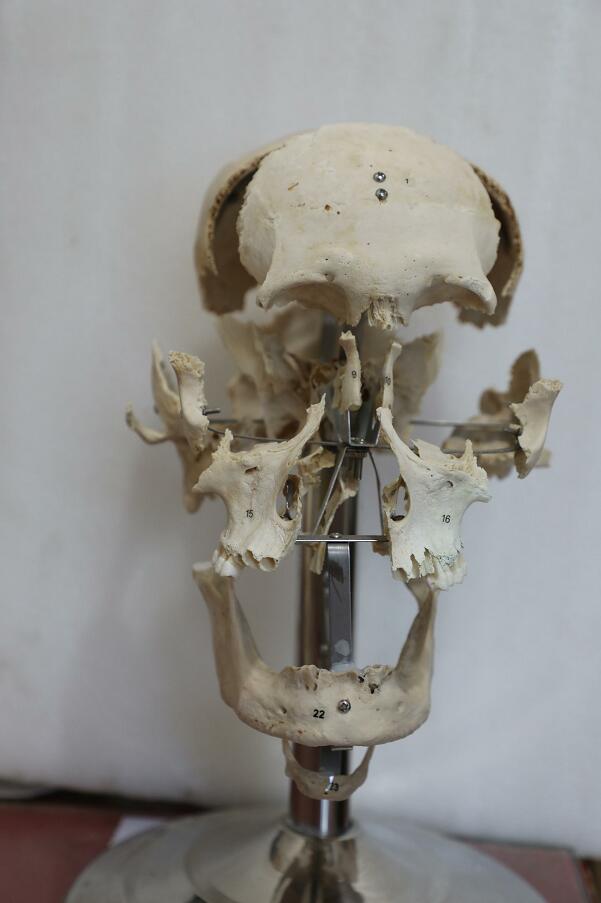 human skull