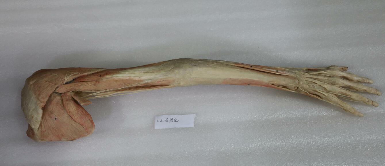 plastination anatomy upper limb