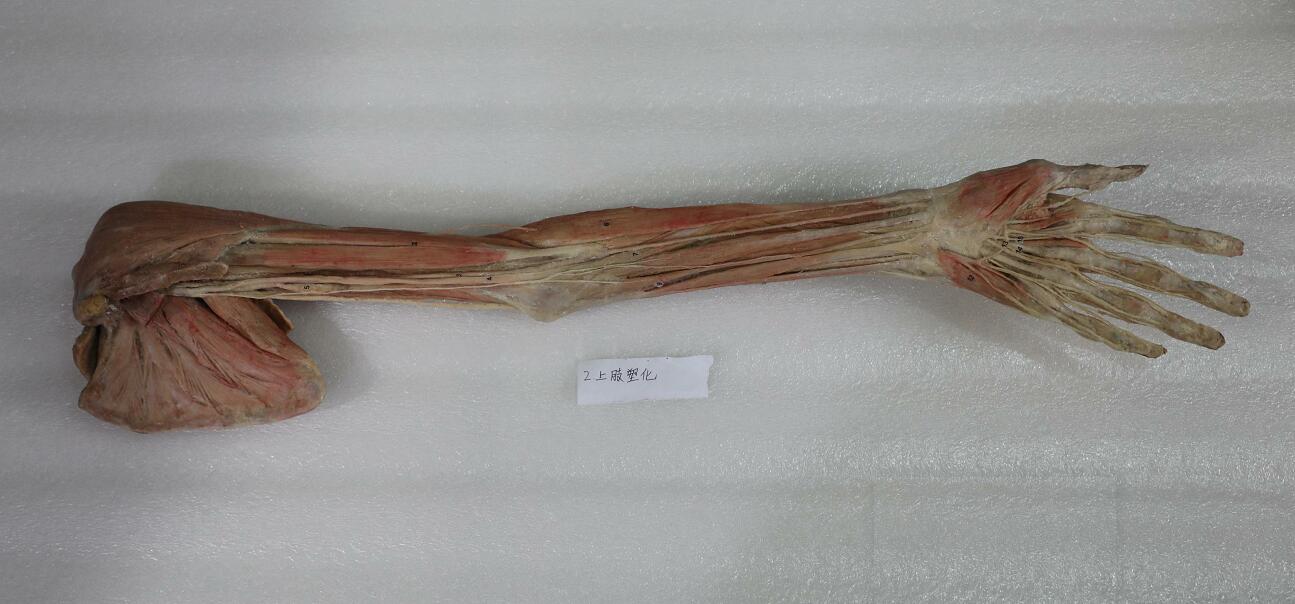 superficial dissection of upper limb plastination