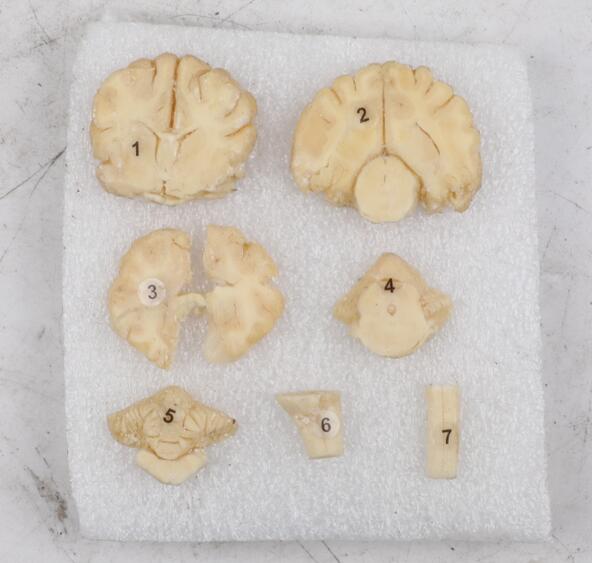 plastianted brain slices of dog