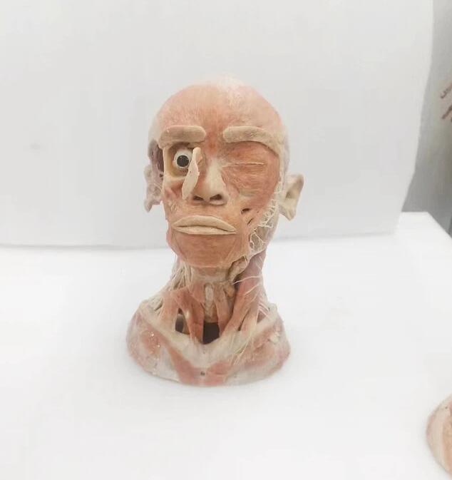 human plastianted model