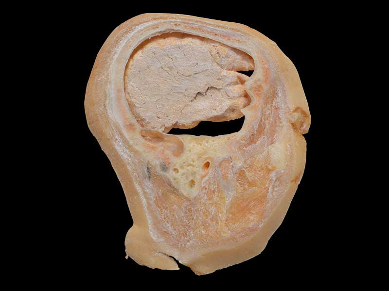 sagittal section of head plastinated specimen