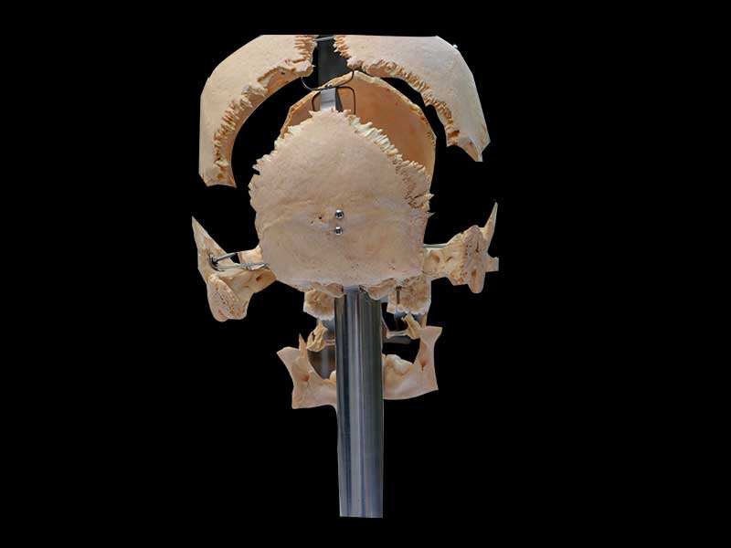 separated human skull plastinated specimen with teeth