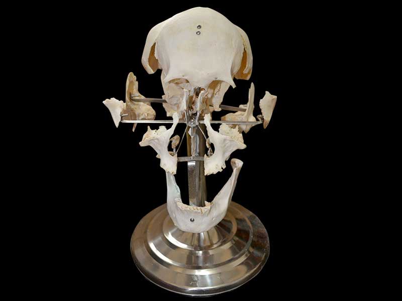 separated skull plastinated specimen
