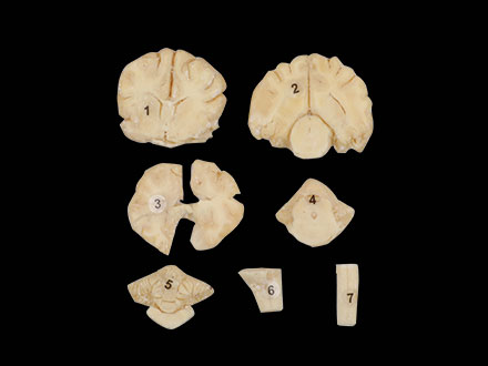 Series Cut of Dog Brain Plastination