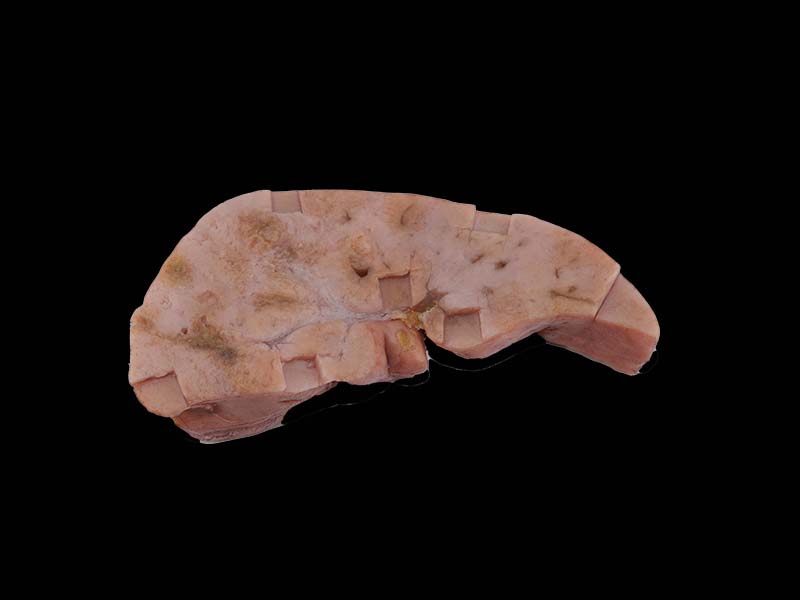 Silicone Hepatic Vascular Endothelial Cell Sarcoma Model