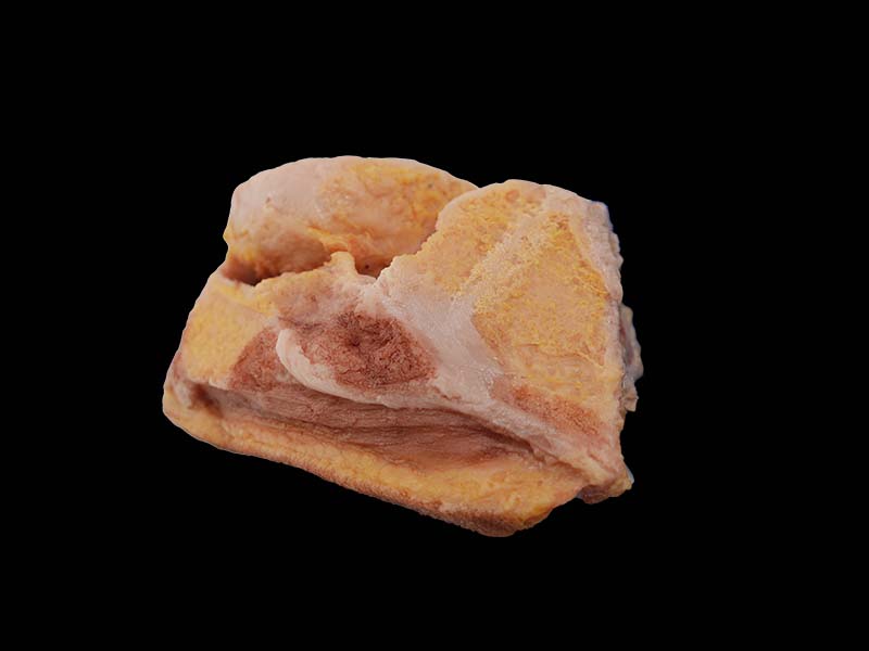 Silicone Tuberculosis of Knee Joint Model