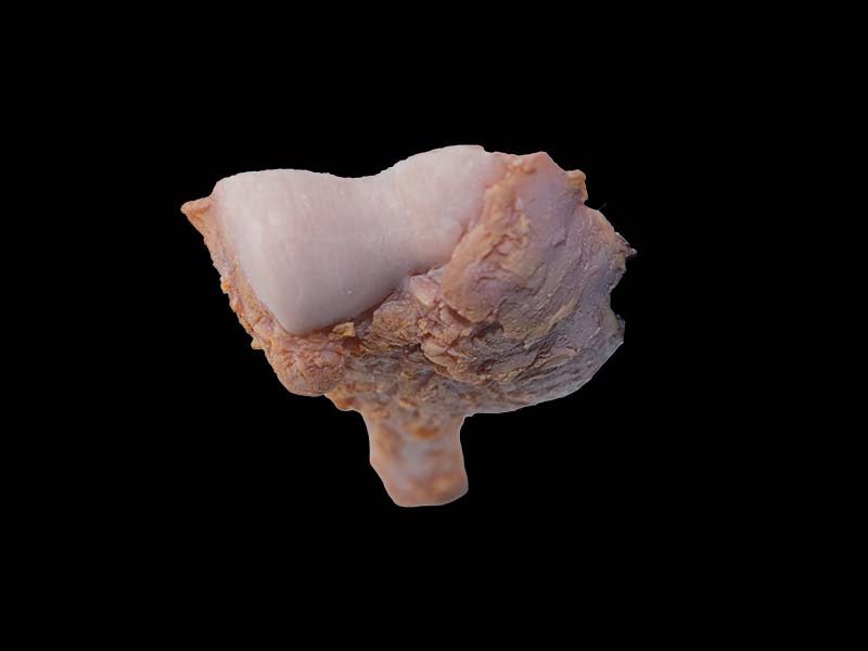 Simulated Osteosarcoma Model
