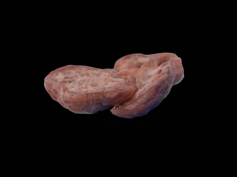 Simulated Renal Tuberculosis Model