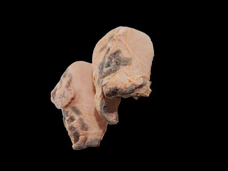 Simulated Uterine Gangrene Model