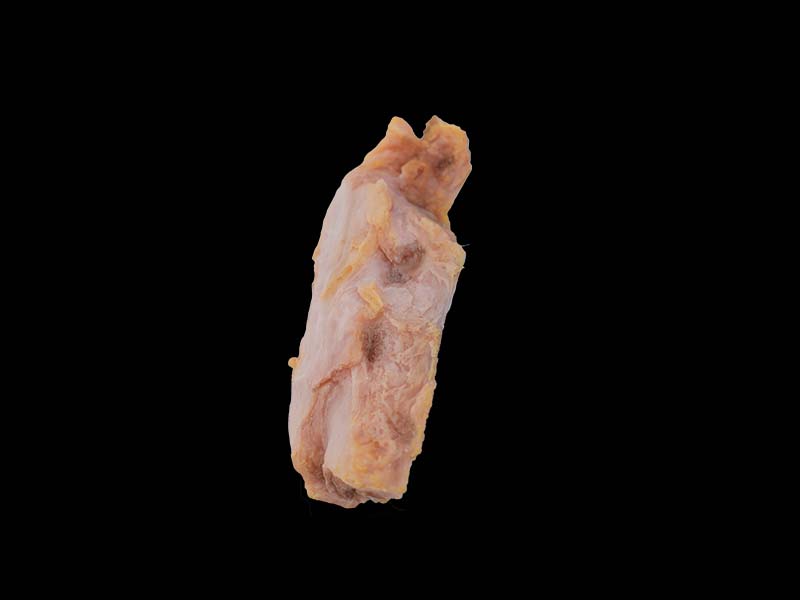Soft Bone Disease Formation Model