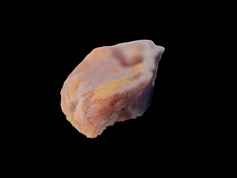 Soft Breast Cancer Simulation Model