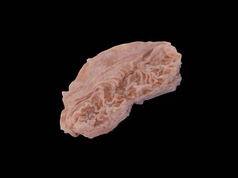 Soft Duodenal Ulcer Model
