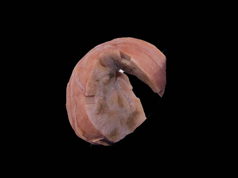 Soft Hepatic Vascular Endothelial Cell Sarcoma Model