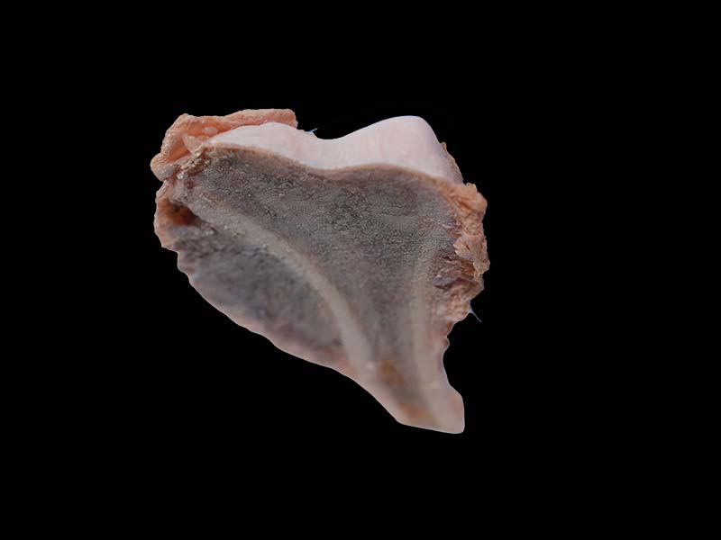 Soft Osteosarcoma Model