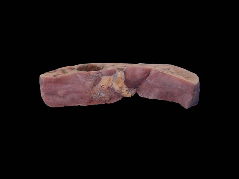 Soft Simulated Bile Duct Epithelial Liver Cancer Anatomy Model