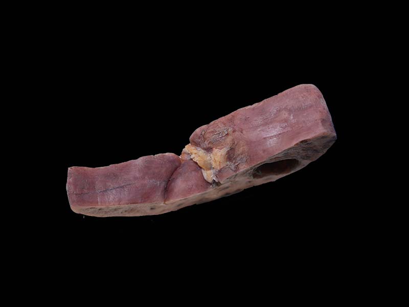 Soft Simulated Bile Duct Epithelial Liver Cancer Model