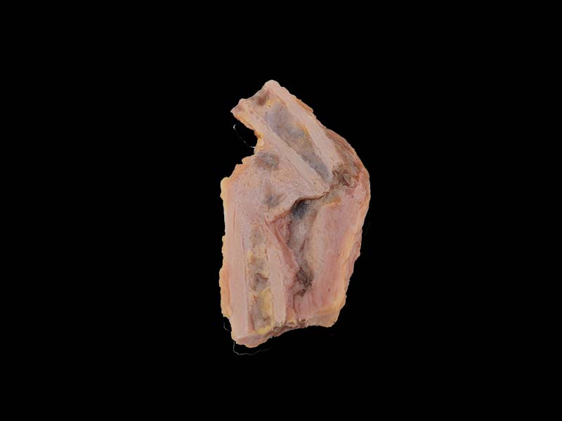 Soft Simulated Bone Disease Formation Anatomy Model