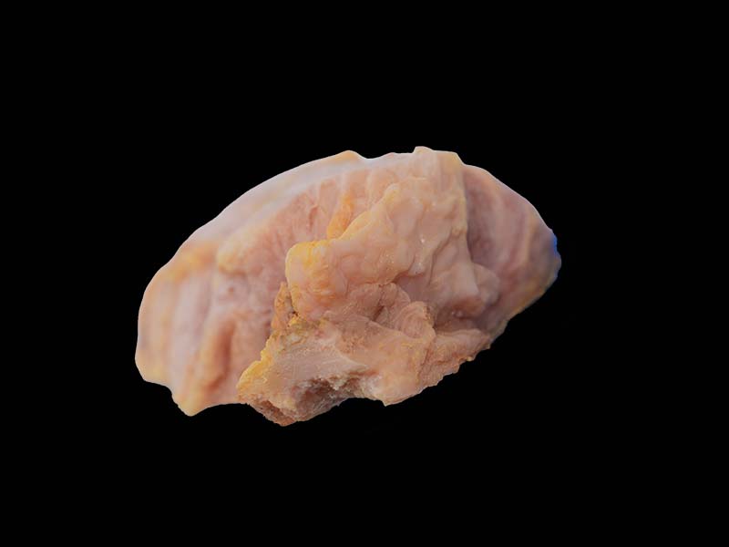 Soft Simulated Bone Disease Formation Model