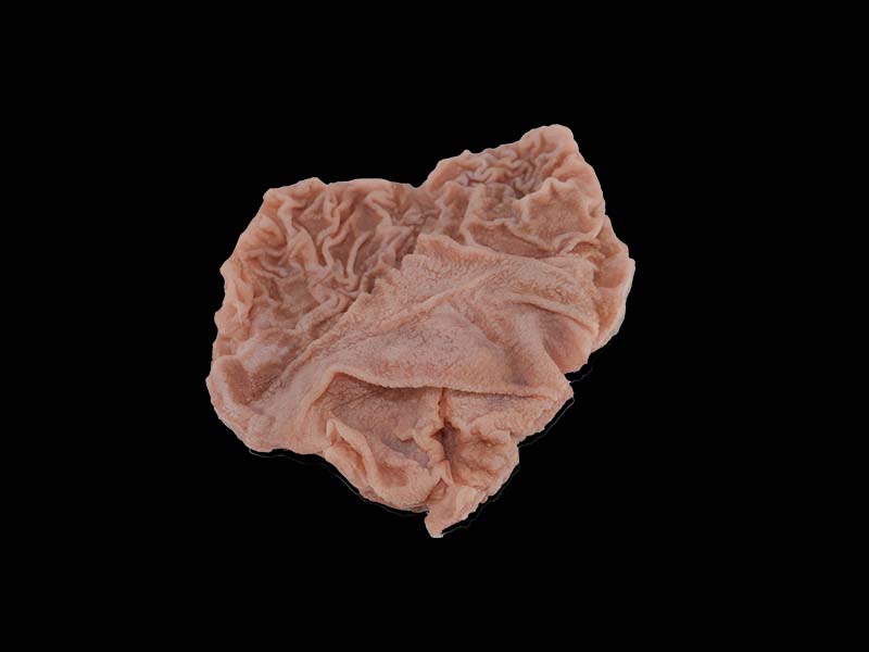 Soft Simulated Duodenal Ulcer Anatomy Model